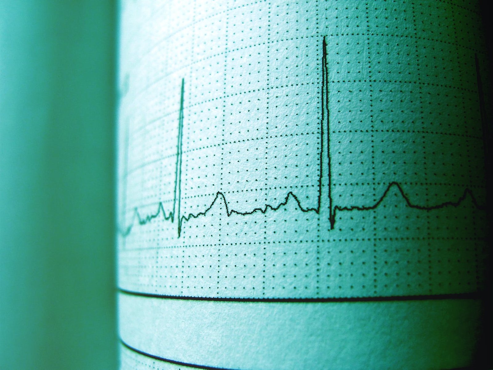 Frecuencias, tablas de frecuencia y niveles de medición